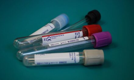 4 pruebas para detectar enfermedades de transmisión sexual